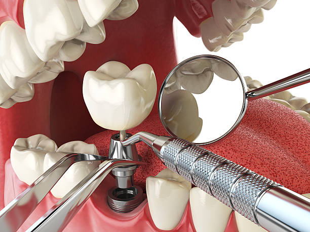 Best Emergency Dental Surgery in Darlington, WI