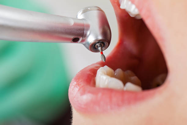 Best Emergency Dental Surgery in Darlington, WI